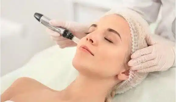 needling e microneedling 1